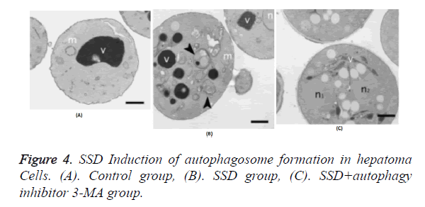 biomedres-autophagosome-formation