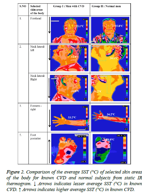 biomedres-average-SST