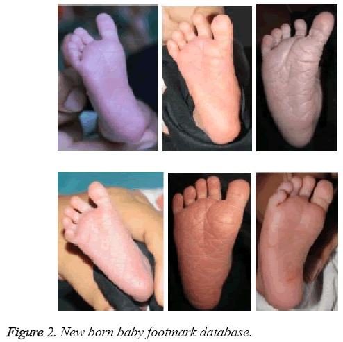 biomedres-baby-footmark-database