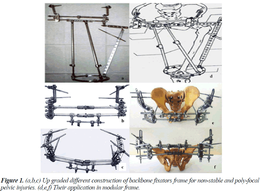 biomedres-backbone-fixators-frame