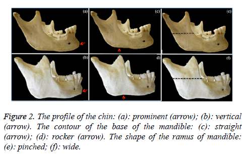 biomedres-base-mandible