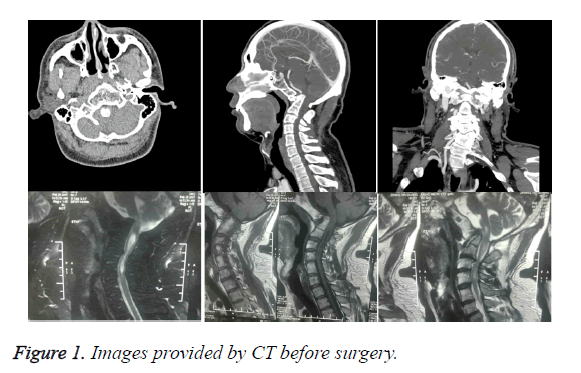 biomedres-before-surgery