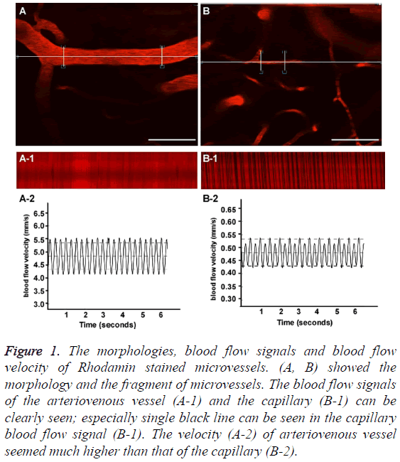 biomedres-blood-flow-signals