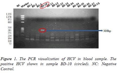 biomedres-blood-sample