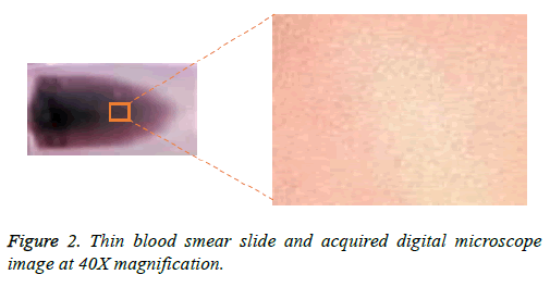 biomedres-blood-smear