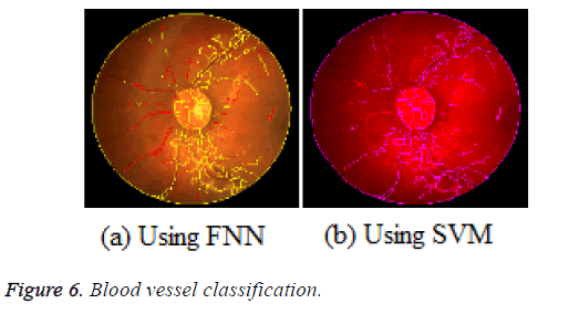 biomedres-blood-vessel-classification