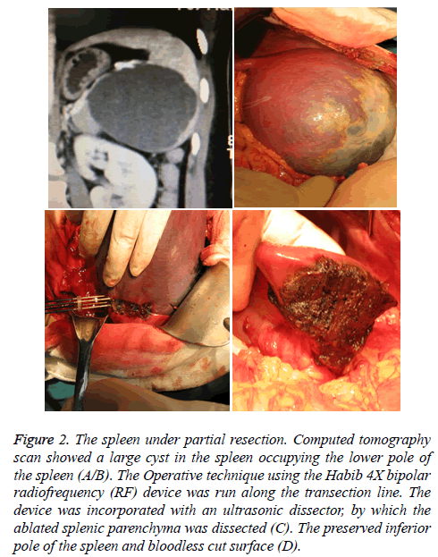 biomedres-bloodless-cut-surface