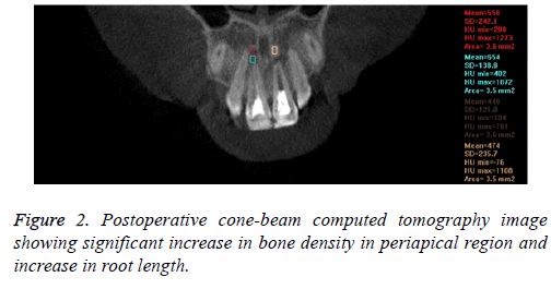 biomedres-bone-density