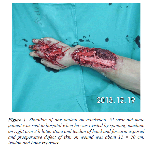 biomedres-bone-exposure