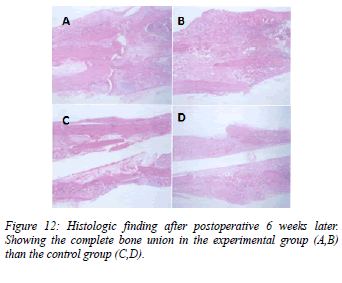 biomedres-bone-union-group