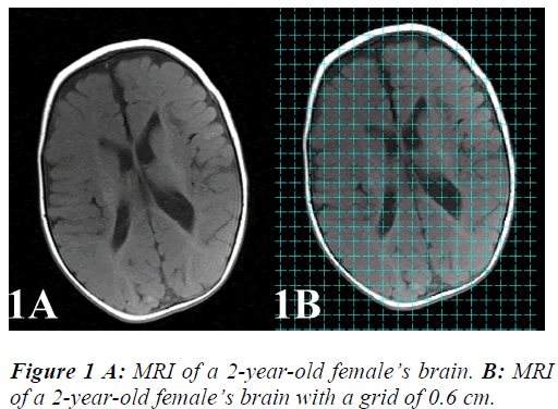 biomedres-brain-with-grid