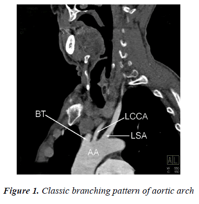 biomedres-branching-pattern-aortic