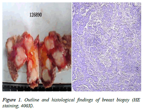 biomedres-breast-biopsy