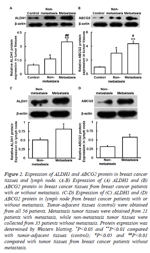 biomedres-breast-cancer