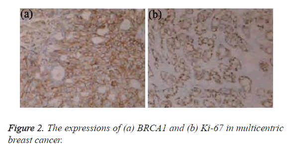 biomedres-breast-cancer