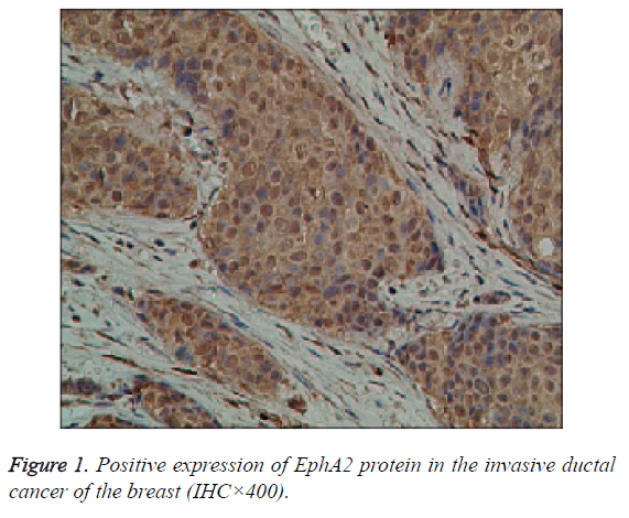 biomedres-breast-cancer