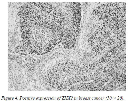 biomedres-breast-cancer