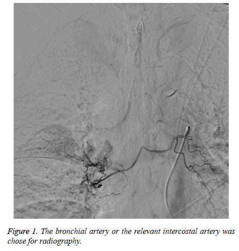 biomedres-bronchial-artery