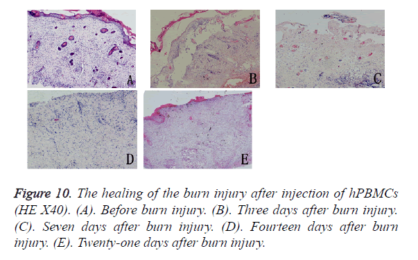 biomedres-burn-injury