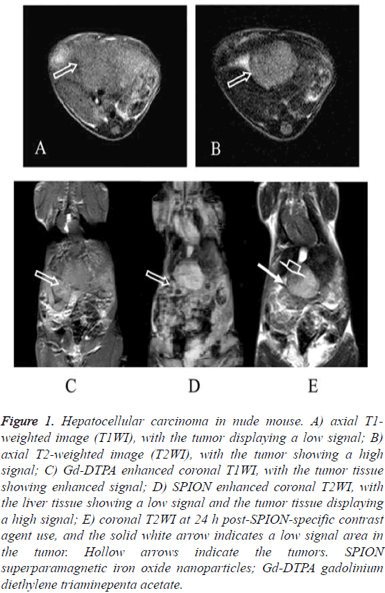 biomedres-carcinoma-nude-mouse