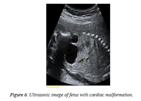 biomedres-cardiac-malformation