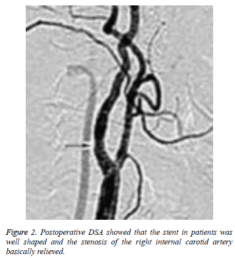 biomedres-carotid-artery