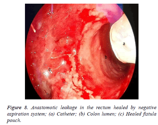 biomedres-catheter-tube