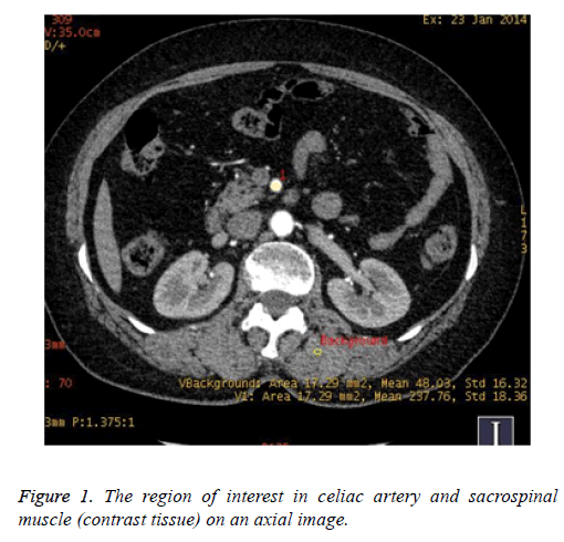 biomedres-celiac-artery