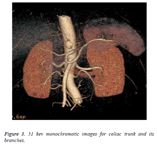 biomedres-celiac-trunk