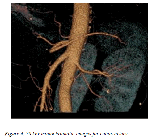 biomedres-celiac-trunk