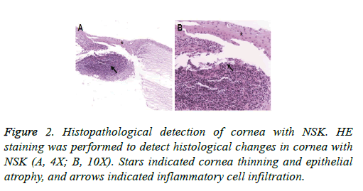 biomedres-cell-infiltration