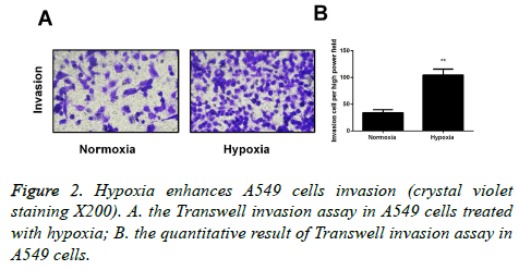 biomedres-cells-invasion