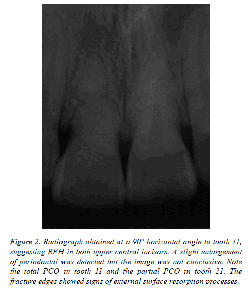 biomedres-central-incisors