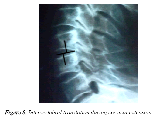 biomedres-cervical-extension