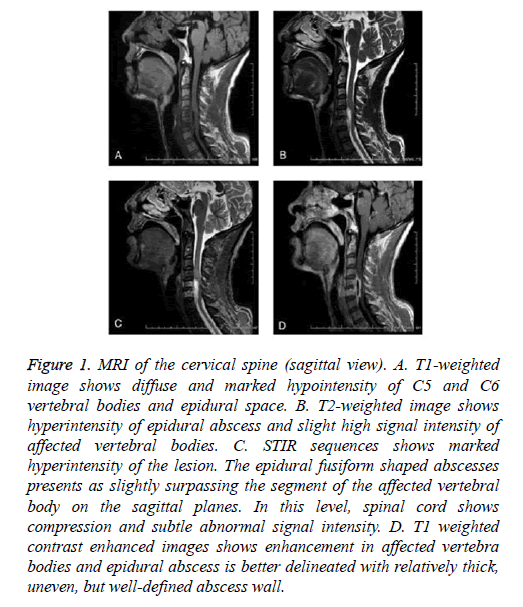 biomedres-cervical-spine