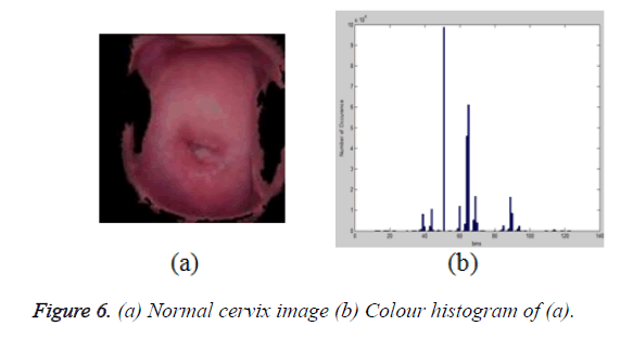 biomedres-cervix-image