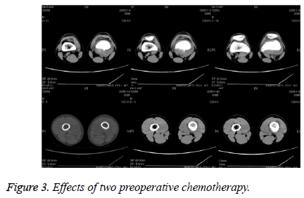 biomedres-chemotherapy