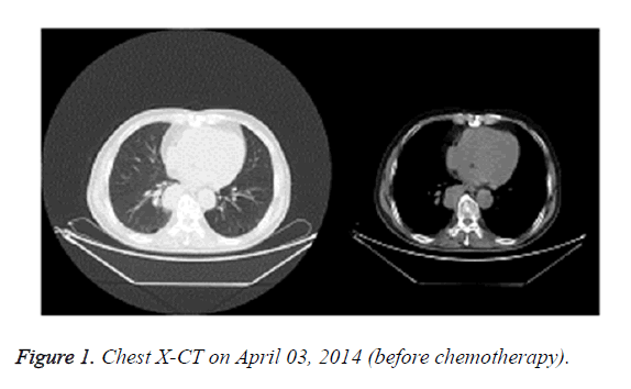 biomedres-chemotherapy