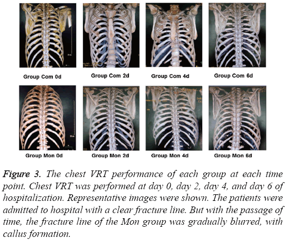 biomedres-chest-VRT-performance