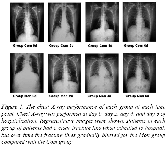 biomedres-chest-X-ray-performance