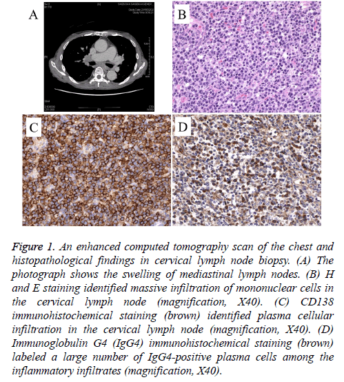 biomedres-chest-lymph