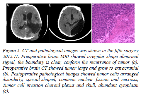 biomedres-choroid-plexus