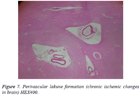 biomedres-chronic-ischemic-brain