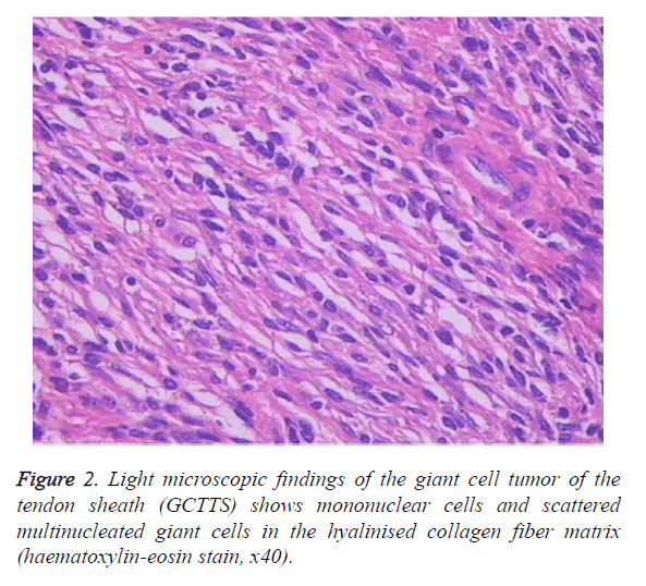 biomedres-collagen-fiber