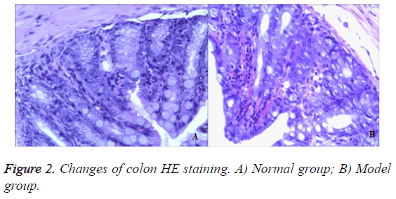 biomedres-colon-HE-staining