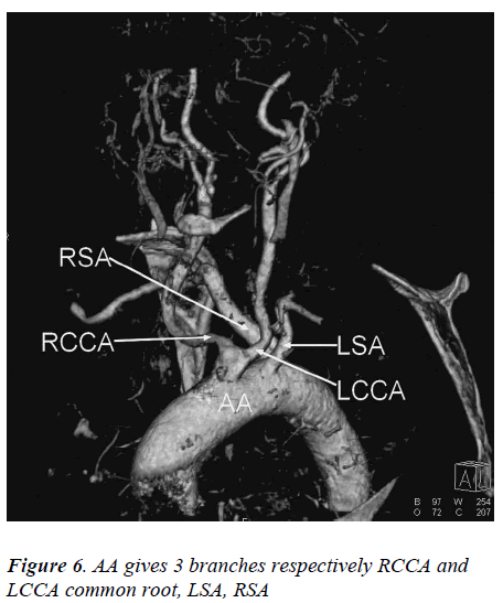 biomedres-common-root-LSA-RSA
