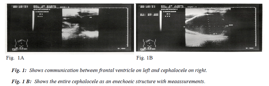 biomedres-communication-frontal-ventricle