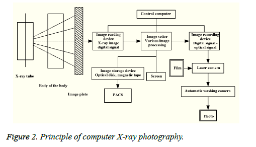 biomedres-computer-X-ray