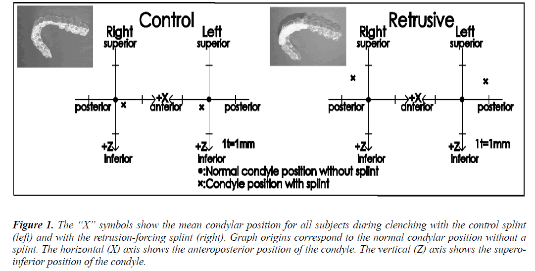 biomedres-condylar-position