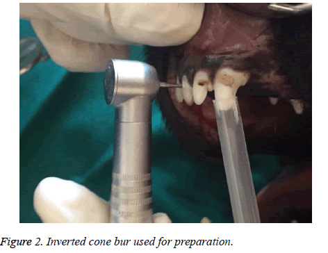 biomedres-cone-bur